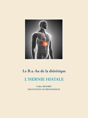 cover image of Le B.a.-ba diététique de l'hernie hiatale